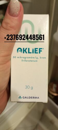 Aklief cream available effective and original