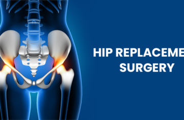 Hip-Replacement