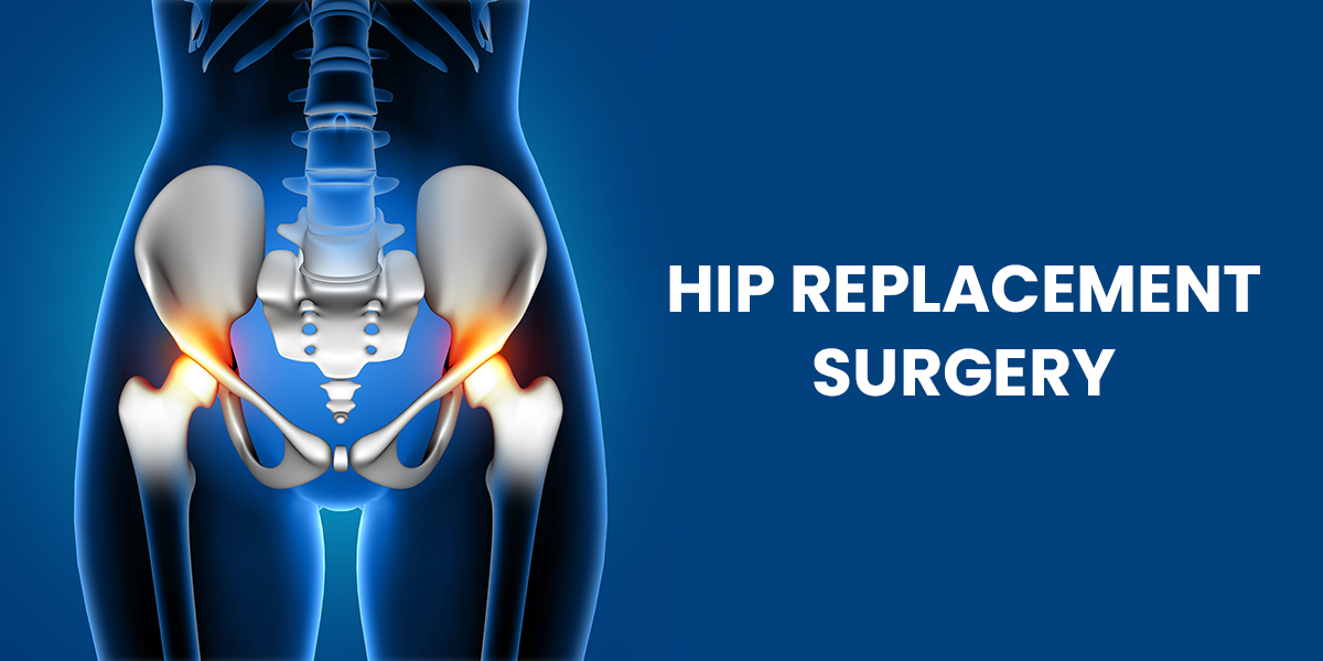 Hip Replacement in India